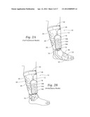 APPARATUS, SYSTEMS, AND METHODS FOR AUGMENTING THE FLOW OF FLUID WITHIN     BODY VESSELS diagram and image