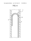 MEDICAL GUIDEWIRE diagram and image