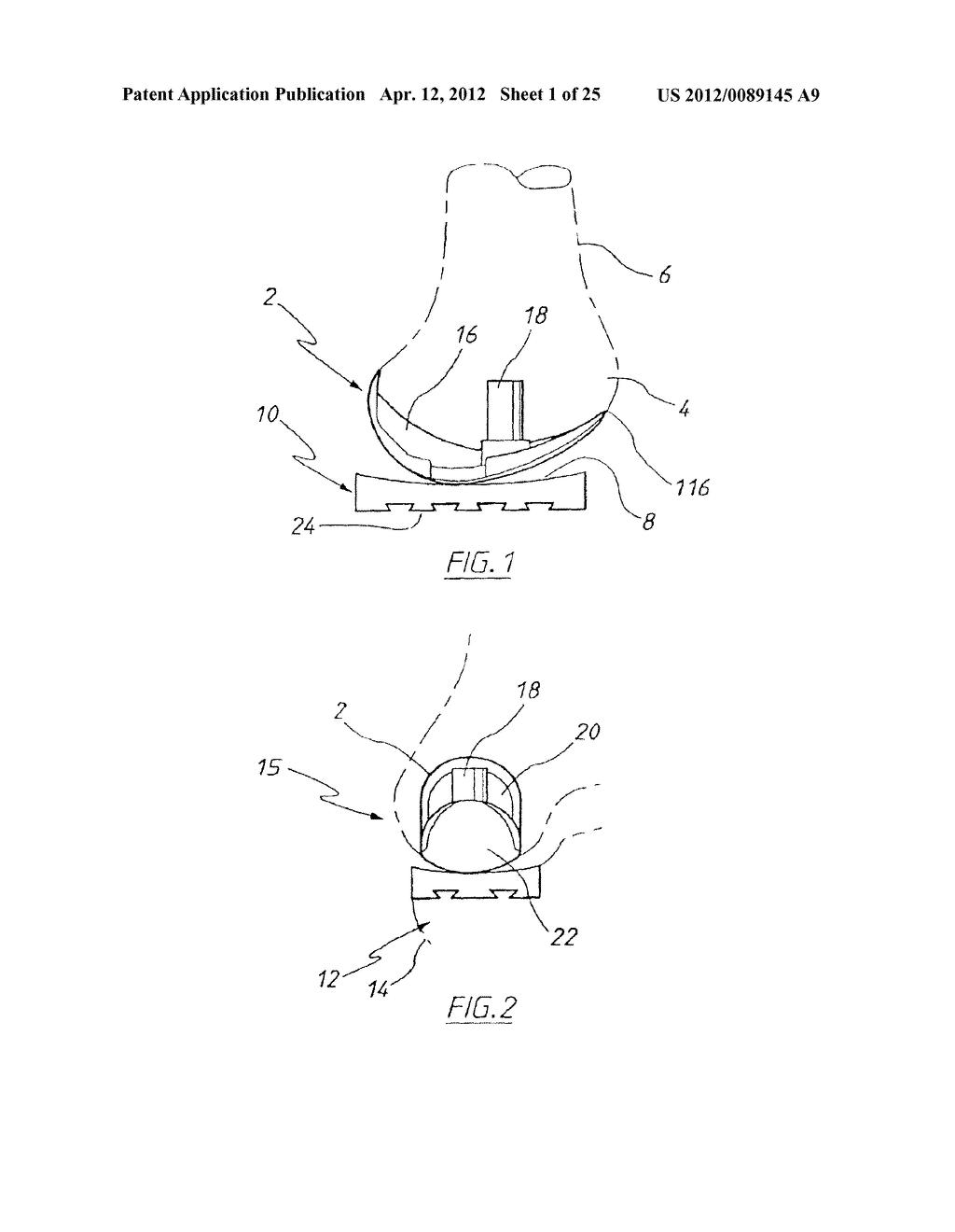 APPARATUS FOR USE IN ARTHROPLASTY ON A KNEE JOINT - diagram, schematic, and image 02