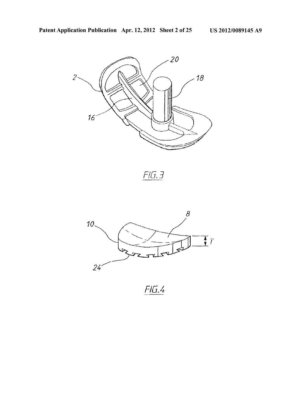 APPARATUS FOR USE IN ARTHROPLASTY ON A KNEE JOINT - diagram, schematic, and image 03