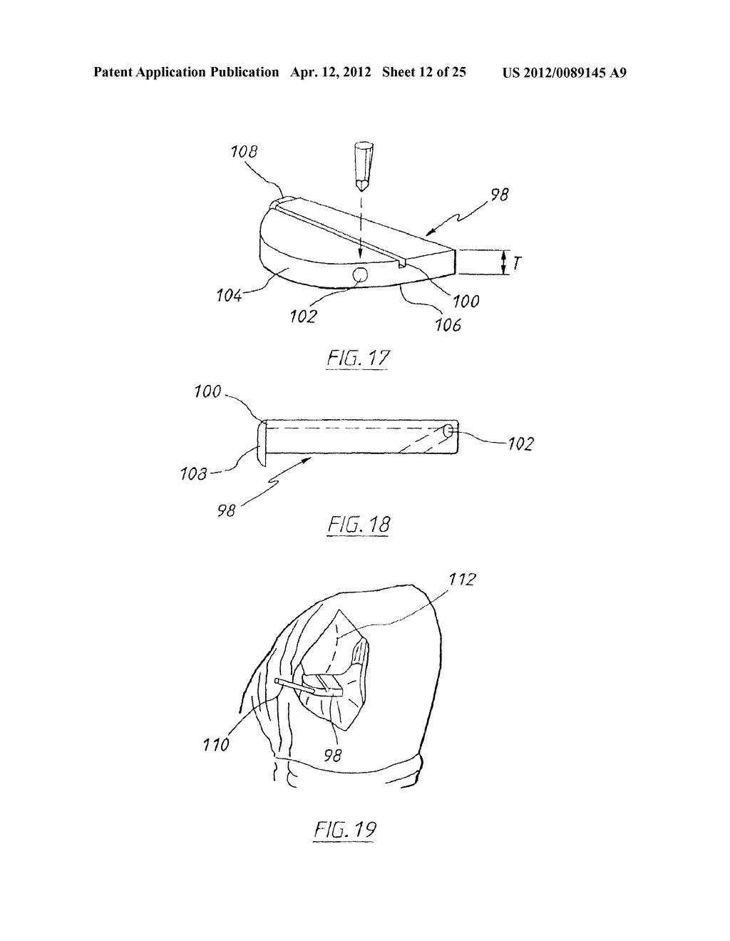 APPARATUS FOR USE IN ARTHROPLASTY ON A KNEE JOINT - diagram, schematic, and image 13