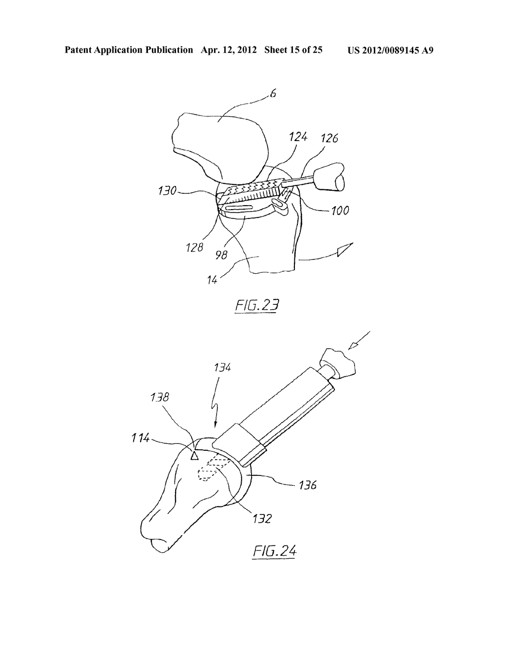 APPARATUS FOR USE IN ARTHROPLASTY ON A KNEE JOINT - diagram, schematic, and image 16