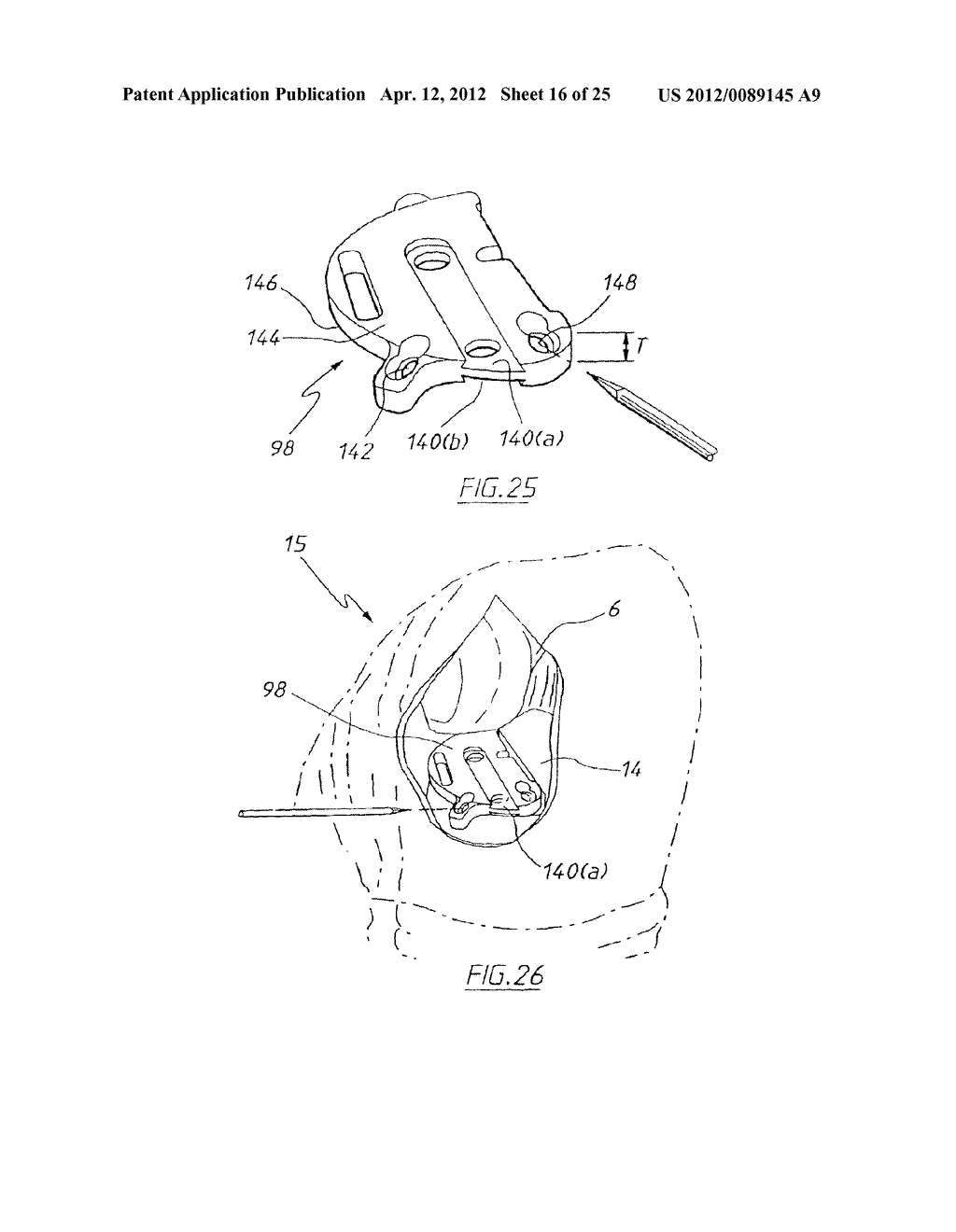 APPARATUS FOR USE IN ARTHROPLASTY ON A KNEE JOINT - diagram, schematic, and image 17