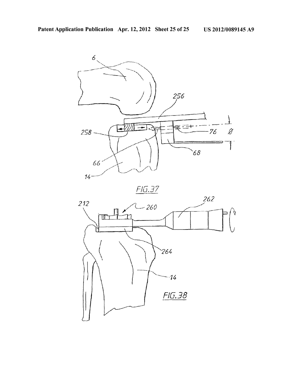 APPARATUS FOR USE IN ARTHROPLASTY ON A KNEE JOINT - diagram, schematic, and image 26