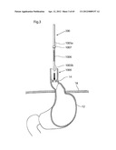 STOMACH INSTRUMENT AND METHOD diagram and image