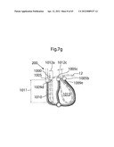 STOMACH INSTRUMENT AND METHOD diagram and image