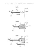 STOMACH INSTRUMENT AND METHOD diagram and image