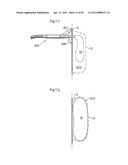 STOMACH INSTRUMENT AND METHOD diagram and image