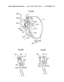 STOMACH INSTRUMENT AND METHOD diagram and image