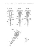 STOMACH INSTRUMENT AND METHOD diagram and image