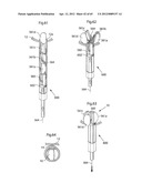 STOMACH INSTRUMENT AND METHOD diagram and image