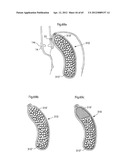 STOMACH INSTRUMENT AND METHOD diagram and image
