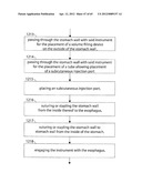 STOMACH INSTRUMENT AND METHOD diagram and image