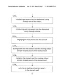 STOMACH INSTRUMENT AND METHOD diagram and image