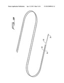 CUTTING WIRE ASSEMBLY FOR USE WITH A CATHETER diagram and image