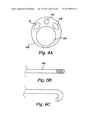 PARTIAL AORTIC OCCLUSION DEVICES AND METHODS FOR CEREBRAL PERFUSION     AUGMENTATION diagram and image