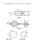 PARTIAL AORTIC OCCLUSION DEVICES AND METHODS FOR CEREBRAL PERFUSION     AUGMENTATION diagram and image