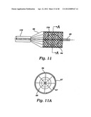 PARTIAL AORTIC OCCLUSION DEVICES AND METHODS FOR CEREBRAL PERFUSION     AUGMENTATION diagram and image