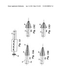 PARTIAL AORTIC OCCLUSION DEVICES AND METHODS FOR CEREBRAL PERFUSION     AUGMENTATION diagram and image