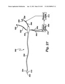 PARTIAL AORTIC OCCLUSION DEVICES AND METHODS FOR CEREBRAL PERFUSION     AUGMENTATION diagram and image