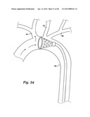 PARTIAL AORTIC OCCLUSION DEVICES AND METHODS FOR CEREBRAL PERFUSION     AUGMENTATION diagram and image