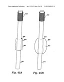 PARTIAL AORTIC OCCLUSION DEVICES AND METHODS FOR CEREBRAL PERFUSION     AUGMENTATION diagram and image