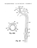 PARTIAL AORTIC OCCLUSION DEVICES AND METHODS FOR CEREBRAL PERFUSION     AUGMENTATION diagram and image