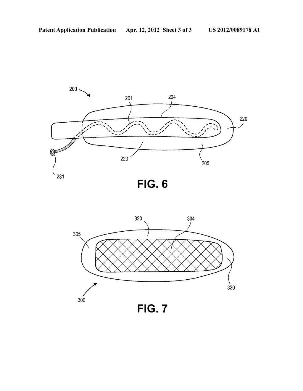 Device and Method to Facilitate Safe, Adhesion-Free Surgical Closures - diagram, schematic, and image 04