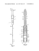 SUTURE LOCK FASTENING DEVICE diagram and image