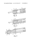 SUTURE LOCK FASTENING DEVICE diagram and image