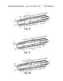 SUTURE LOCK FASTENING DEVICE diagram and image