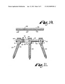 Dynamic stabilization connecting member with slitted core and outer sleeve diagram and image