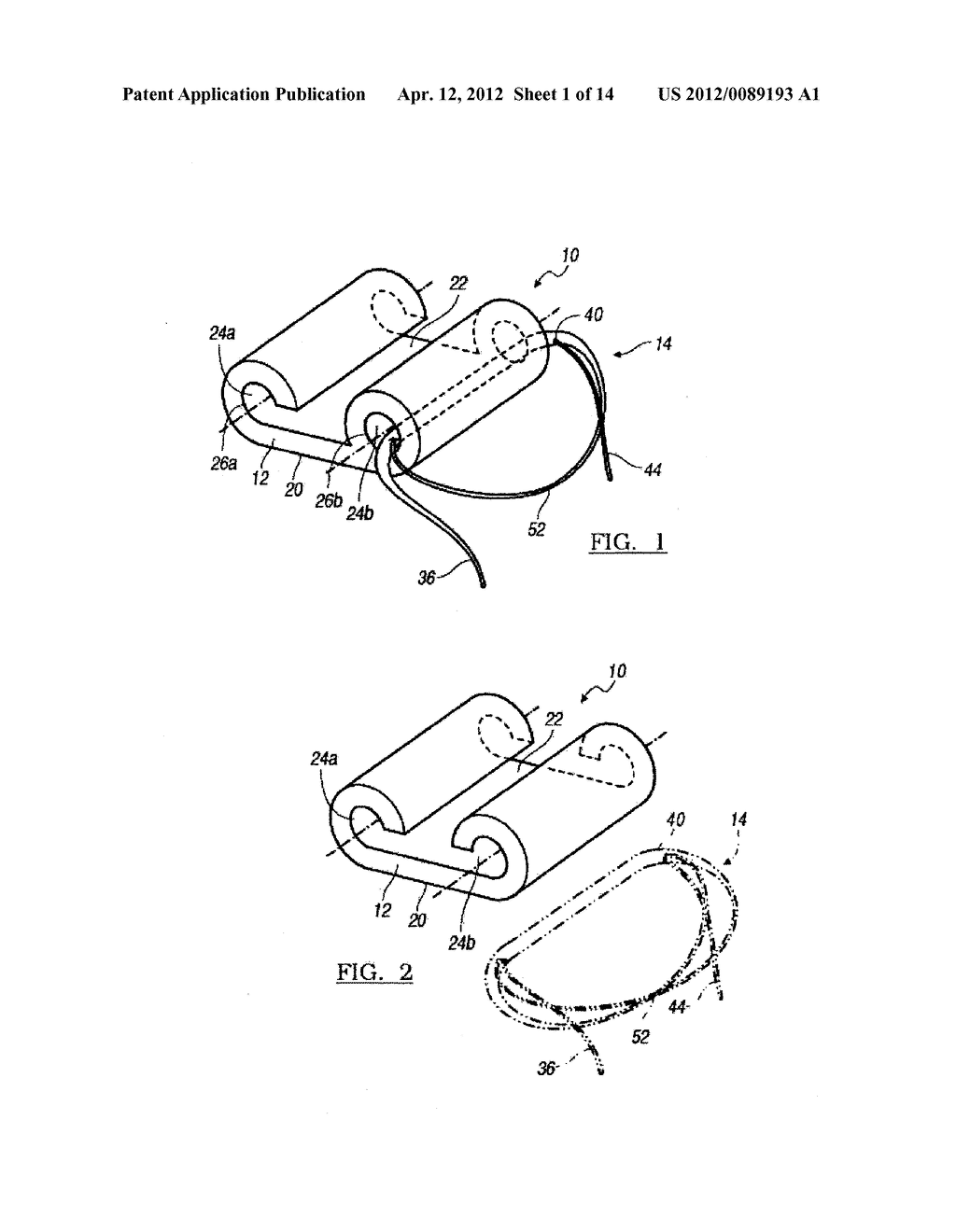 Fracture Fixation Device - diagram, schematic, and image 02