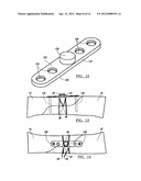 Fracture Fixation Device diagram and image