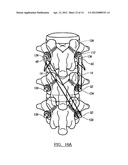 Fracture Fixation Device diagram and image