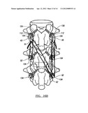 Fracture Fixation Device diagram and image