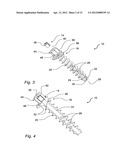 SYSTEM AND METHOD FOR SELF FILLING BONE SCREWS diagram and image