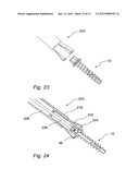 SYSTEM AND METHOD FOR SELF FILLING BONE SCREWS diagram and image