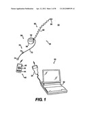 Obstructive Sleep Apnea Treatment Devices, Systems and Methods diagram and image