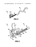 Obstructive Sleep Apnea Treatment Devices, Systems and Methods diagram and image