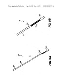 Obstructive Sleep Apnea Treatment Devices, Systems and Methods diagram and image