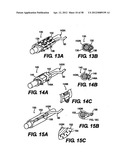 Obstructive Sleep Apnea Treatment Devices, Systems and Methods diagram and image