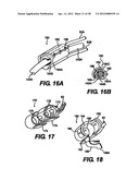 Obstructive Sleep Apnea Treatment Devices, Systems and Methods diagram and image