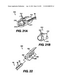 Obstructive Sleep Apnea Treatment Devices, Systems and Methods diagram and image