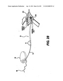 Obstructive Sleep Apnea Treatment Devices, Systems and Methods diagram and image