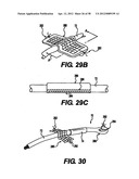 Obstructive Sleep Apnea Treatment Devices, Systems and Methods diagram and image