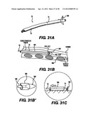 Obstructive Sleep Apnea Treatment Devices, Systems and Methods diagram and image