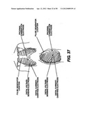 Obstructive Sleep Apnea Treatment Devices, Systems and Methods diagram and image