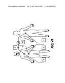 Obstructive Sleep Apnea Treatment Devices, Systems and Methods diagram and image