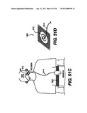 Obstructive Sleep Apnea Treatment Devices, Systems and Methods diagram and image